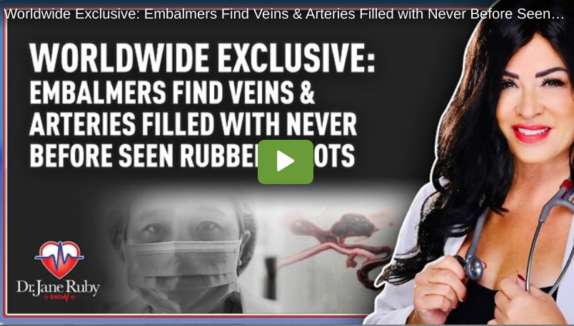Dr Jane Ruby Show: “Embalmers Find Veins & Arteries Filled with Never Before Seen Rubbery Clots”